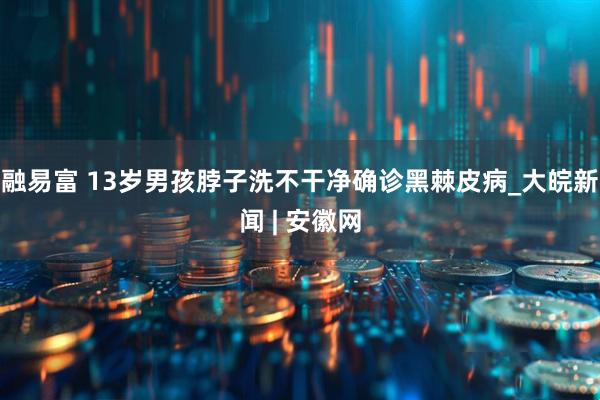 融易富 13岁男孩脖子洗不干净确诊黑棘皮病_大皖新闻 | 安徽网